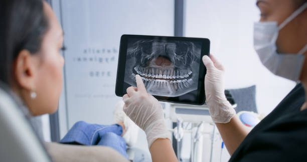 Licensed Dental Implants service in Hamshire, TX - Smile Center Dentistry