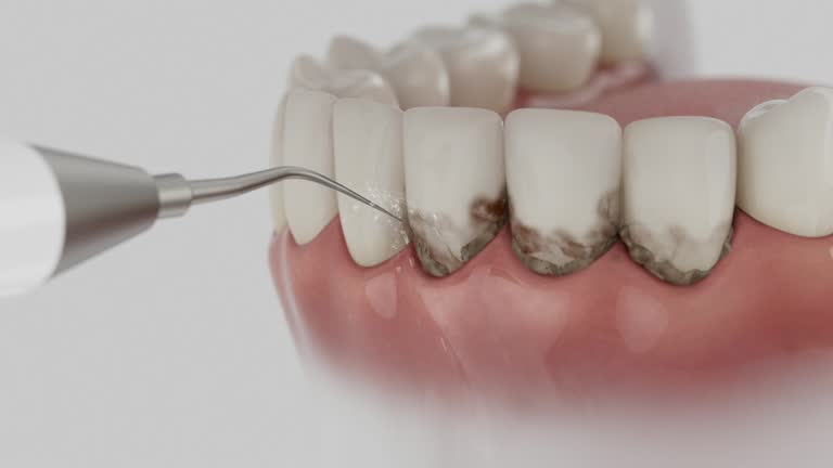 Reliable Dental Implants contractor in Hamshire, TX by Smile Center Dentistry
